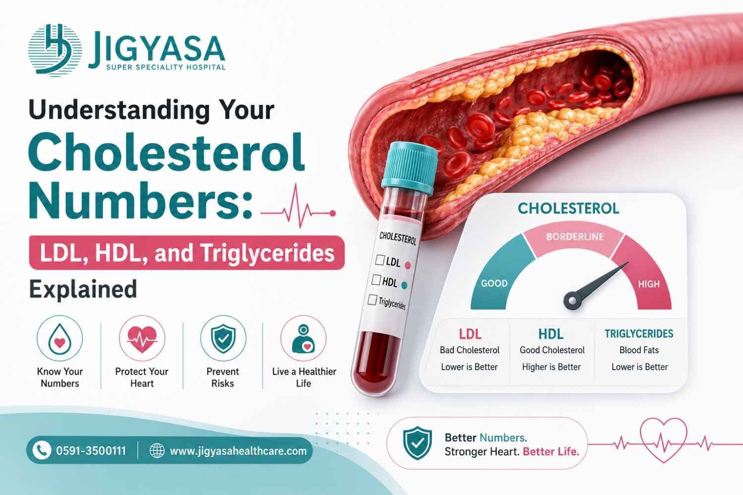 Understanding Your Cholesterol Numbers: LDL, HDL, and Triglycerides Explained